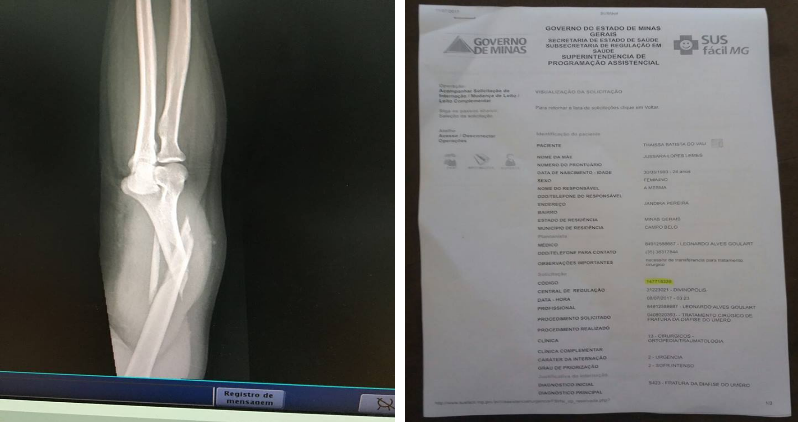 Campo Belo Jovem Fratura No Bra O Aguarda Por Cirurgia H Dias